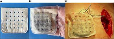 Physician antibiotic hydration preferences for biologic antibacterial envelopes during cardiac implantable device procedures